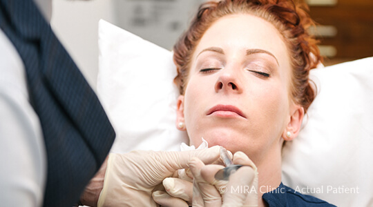 Chin Enhancement - 4 - Mira Clinic Chin enhancement - chin fillers perth - mira clinic - image 002