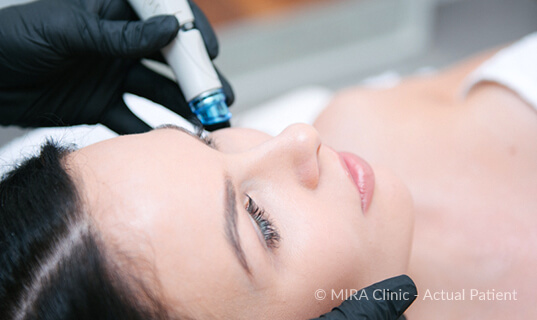 Hydrafacial mirapatient 2 - mira clinic - 5