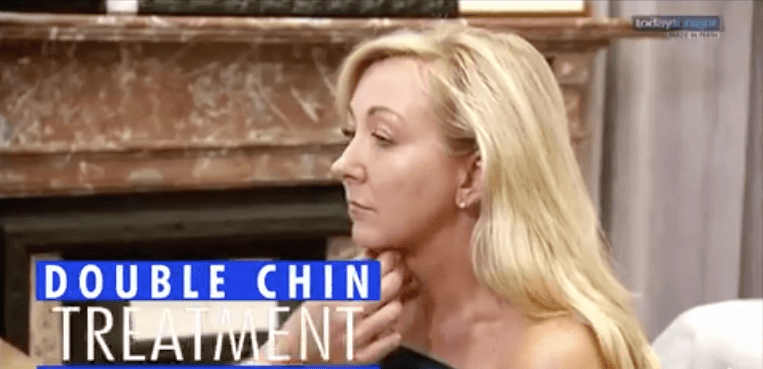 Fat dissolving double chin treatment - mira clinic