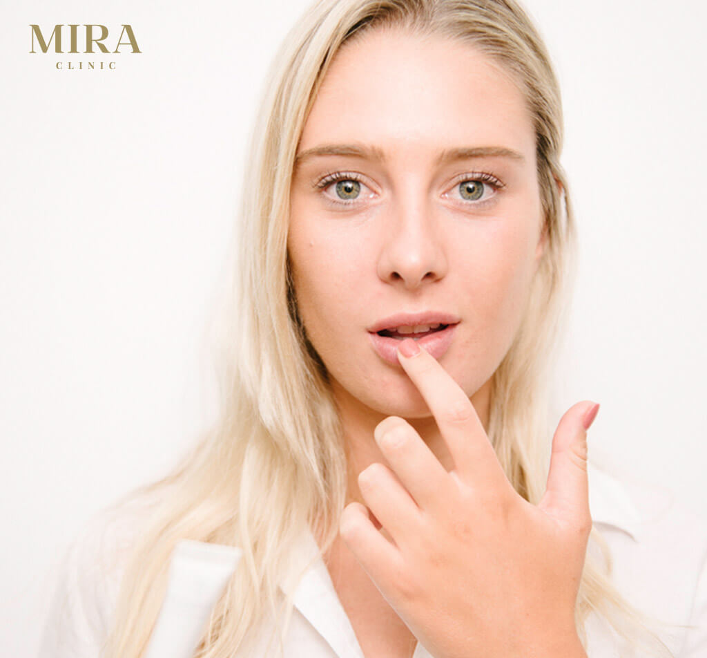 Lip fillers model - lip injections - real patient - image 001