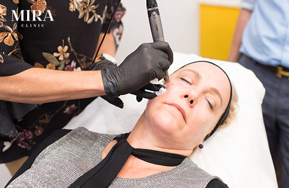 Skinpen - 2 - Mira Clinic Dermapen image 1 - mira clinic - 1
