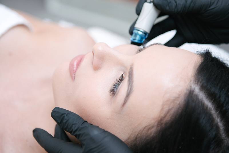 Hydrafacial treatment at mira clinic perth - image 004