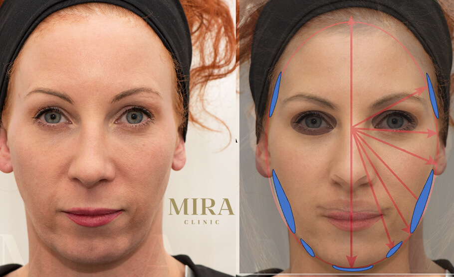 Mira clinic patient treatment recommendation - mira clinic - 3